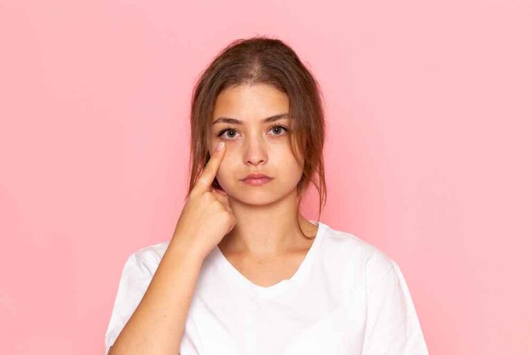 Dark Circles Under Eyes