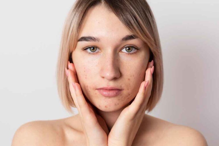 Dark spots on the skin