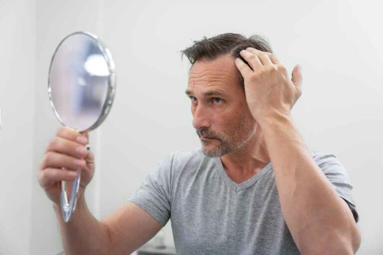 Hair Loss: Causes