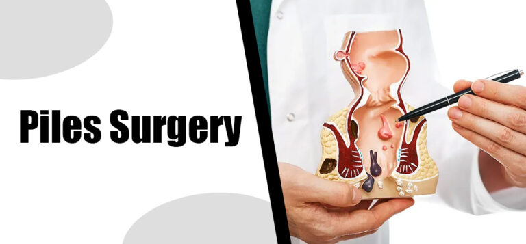 Top Piles Surgeon in Gurgaon